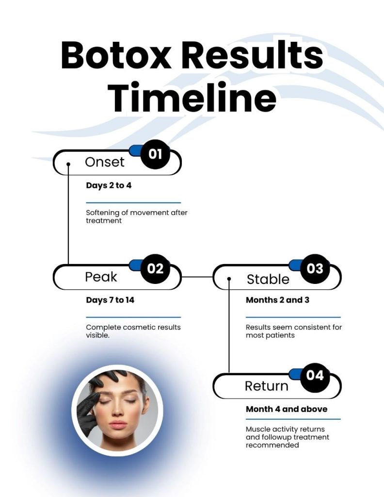 How long does Botox last