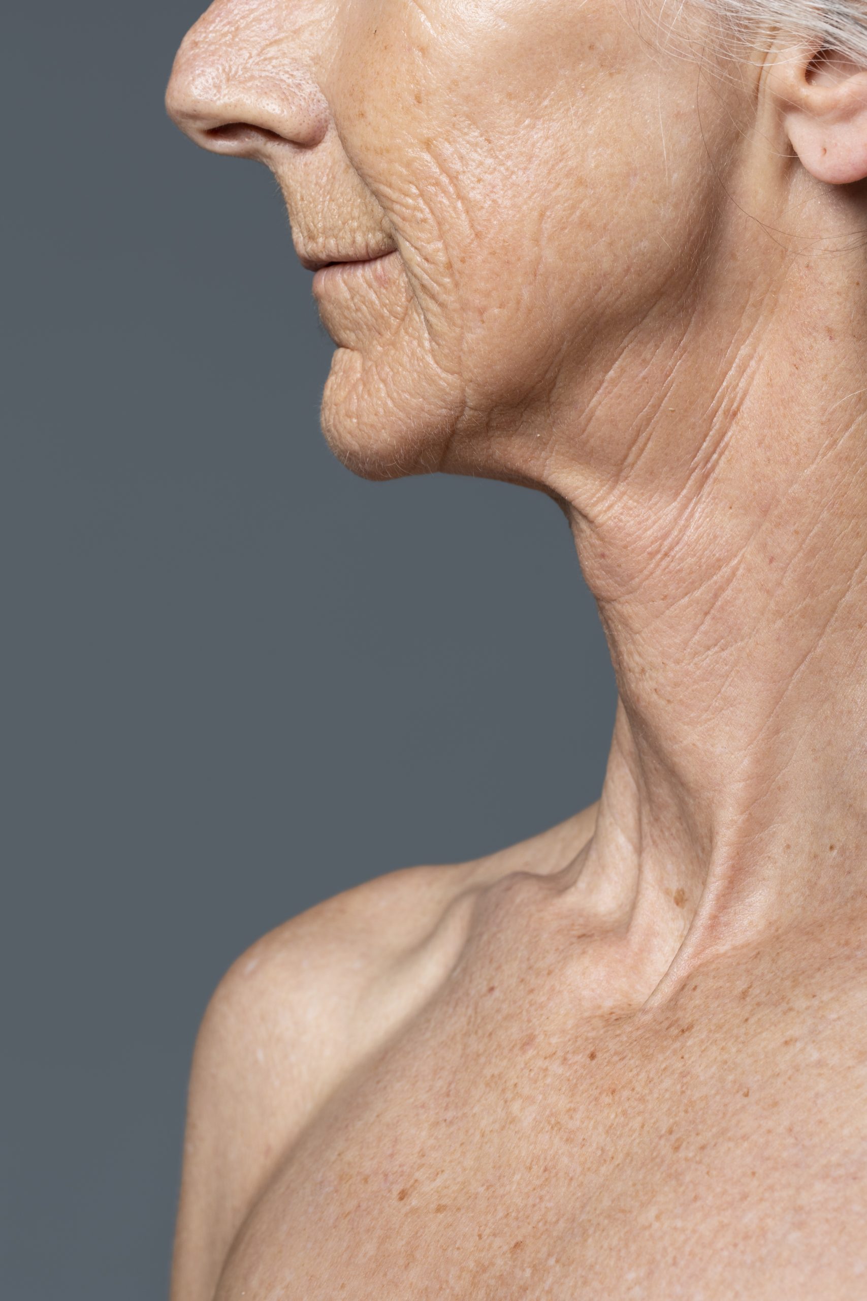Nefertiti Lift